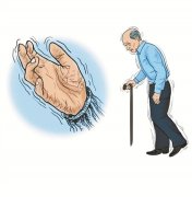 帕金森的主要症状有哪些?