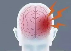 常年偏头痛怎么办